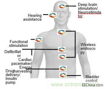 植入無(wú)線電應(yīng)用示例