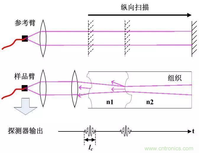 解讀光學相干層析成像技術(shù)