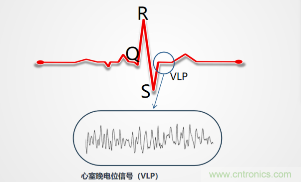 解決心電監(jiān)測行業(yè)難題，曼森伯格的濾波技術(shù)獲國家知識產(chǎn)權(quán)局發(fā)明授權(quán)